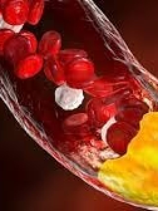 এই সবজি চিবিয়ে খান, তাতেই হুড়মুড়িয়ে কমবে কোলেস্টেরল