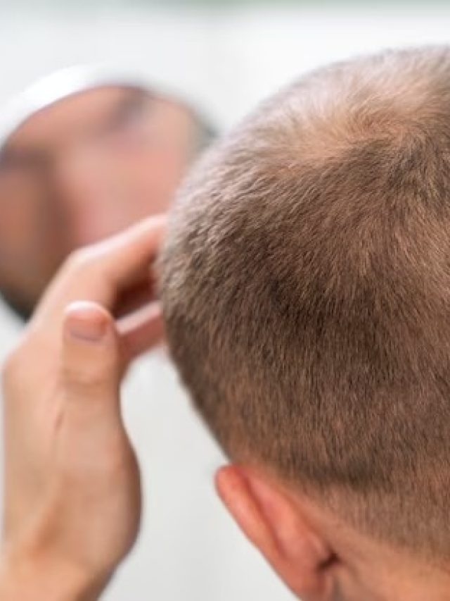 আদা দিয়েই টাকে চুল গজিয়ে জঙ্গল করে ফেলুন, কীভাবে করবেন?