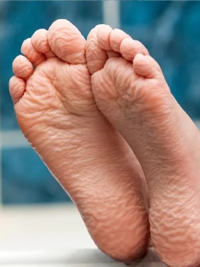 বৃষ্টিতে ভিজে গেলে হাত ও পায়ের চামড়া কুঁচকে যায় কেন? অনেকেই জানে না