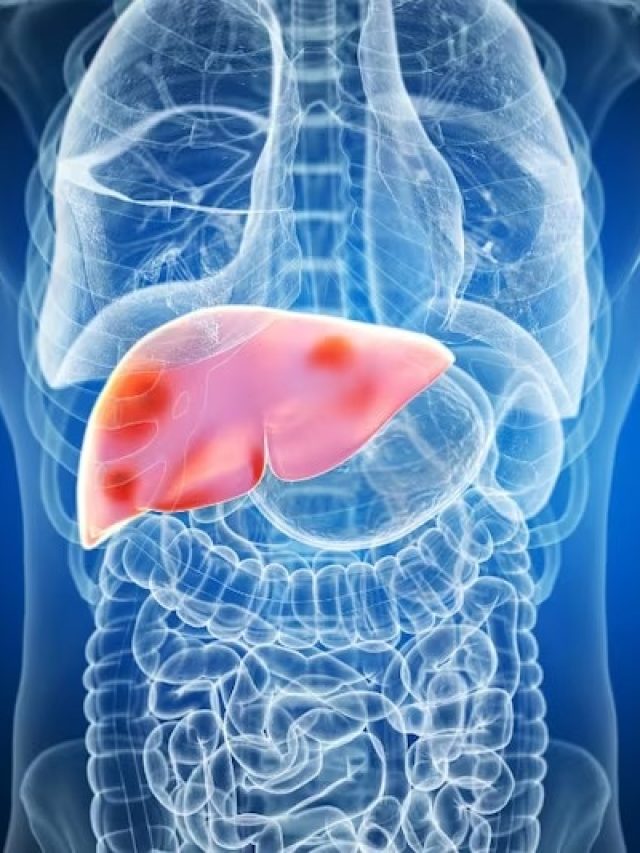 লিভারের বারোটা  বাজায় এসব খাবার, খেলেই ভুগবেন