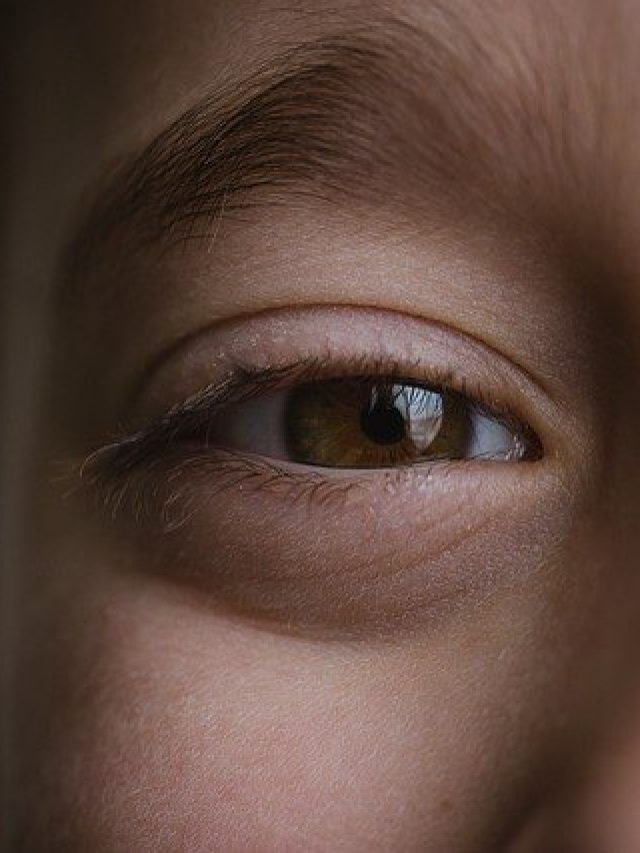 Puffy Eyes से परेशान हैं तो अपनाएं ये टिप्स,जल्द मिलेगा आराम