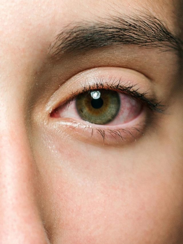 চোখের তলায় ফোলা ভাব? সামাল দেবে পার্লার দিদির ৭ টিপস