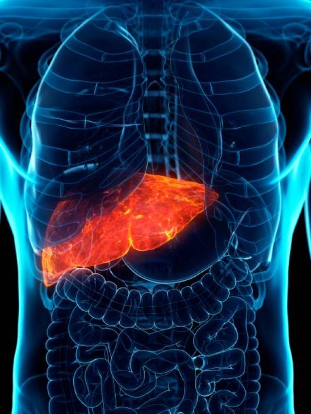 बिना शराब पिए भी लिवर हो जाएगा खराब, अगर बिना सोचे-समझे खाते रहेंगे ये चीजें