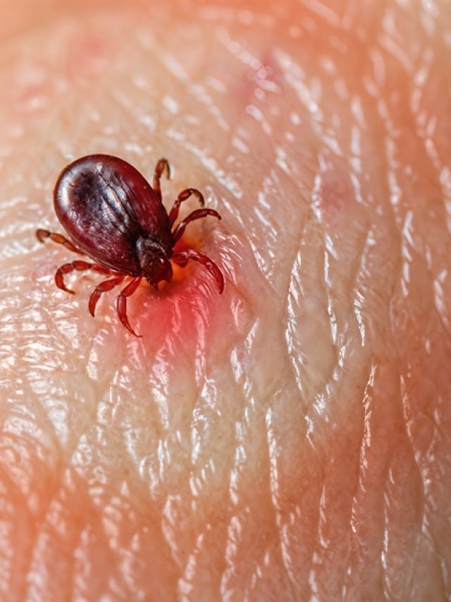 Joe Rogan’s chilling claim: Did the U.S. unleash Lyme Disease as a bioweapon?