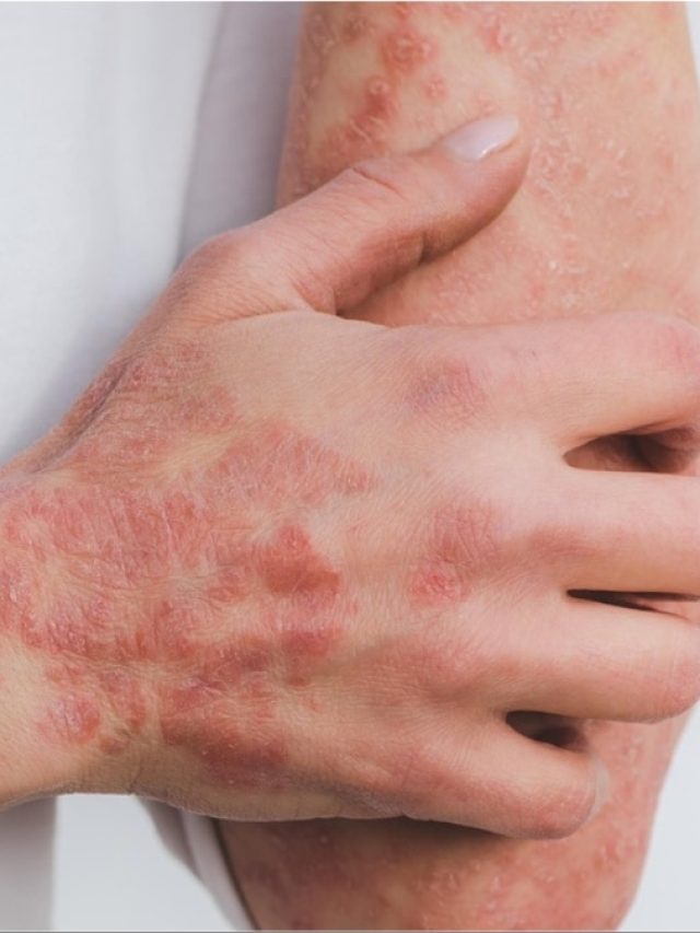 स्किन की किसी भी दिक्कत के लिए बेस्ट हैं ये चीजें, स्वामी रामदेव से जानें