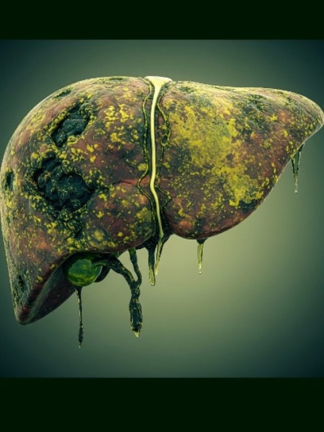 लिवर को 'कूड़ाघर' बना सकते हैं ये 5 देसी हर्बल सप्लीमेंट्स! संभल जाएं वरना होगा पछतावा