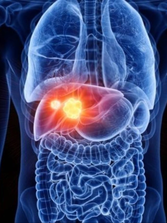 लिवर खराब होने से पहले देता है ये संकेत... आंख, हाथ और पंजों में शुरू हो जाती हैं दिक्कतें