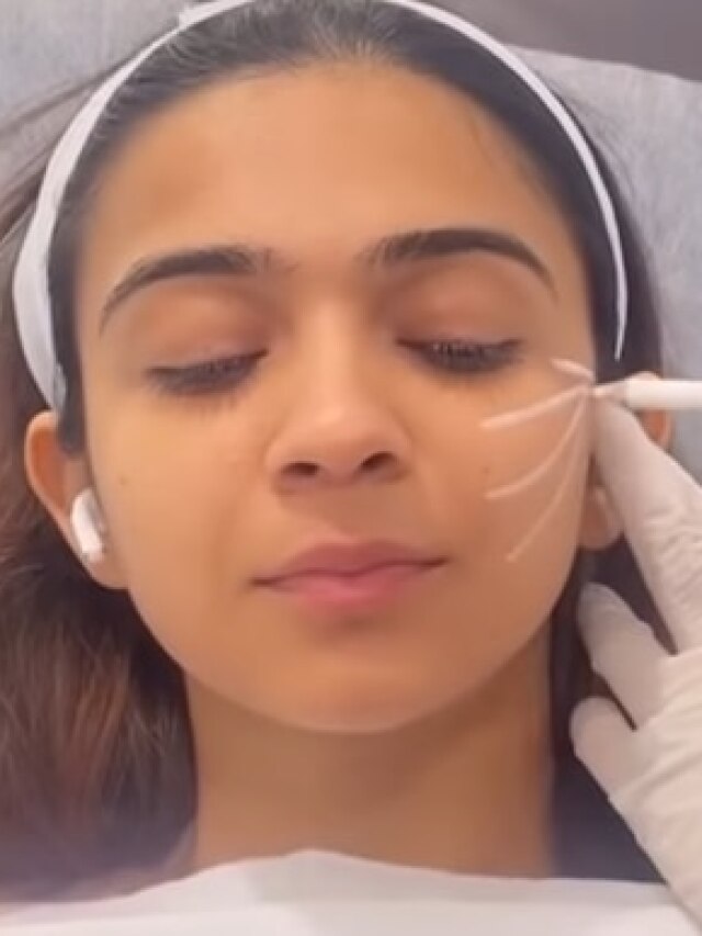 23 साल की करोड़पति यूट्यूबर ने लिए फेस इंजेक्शन्स, VIDEO हुआ लीक, यूजर्स बोले- इतनी सी...