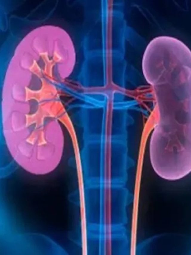 এসব খাবার খেলে কিডনিতে স্টোন তৈরি হয়