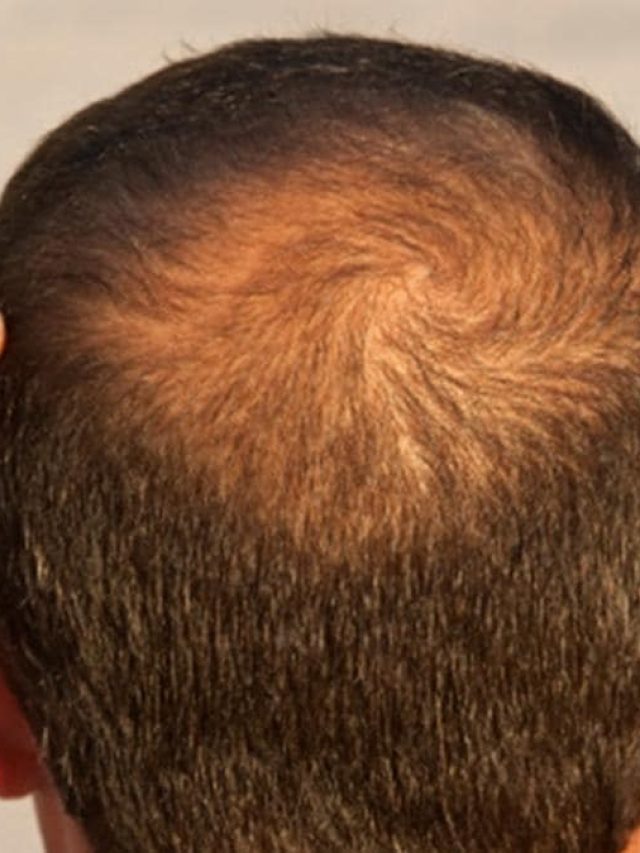 রান্নাঘরের এই মশলা দিয়েই চুল হবে ঘন, নিয়মটা জেনে নিন