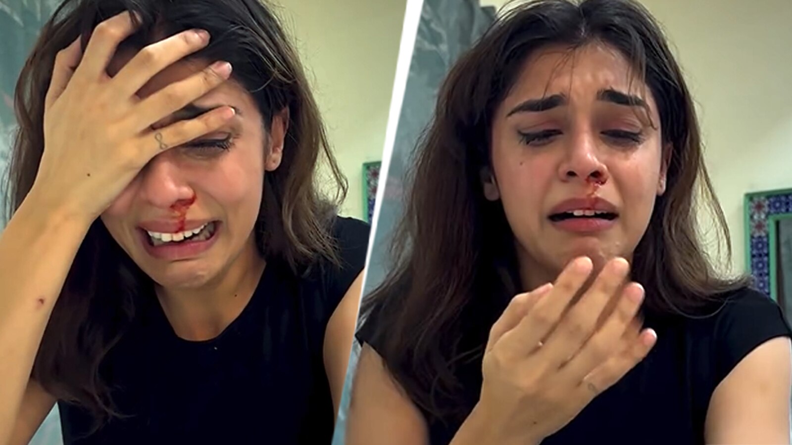 नाक से बहता खून-आंखों में आंसू, रोती बिलखती एक्ट्रेस का बुरा हाल, Video देख शॉक्ड फैंस