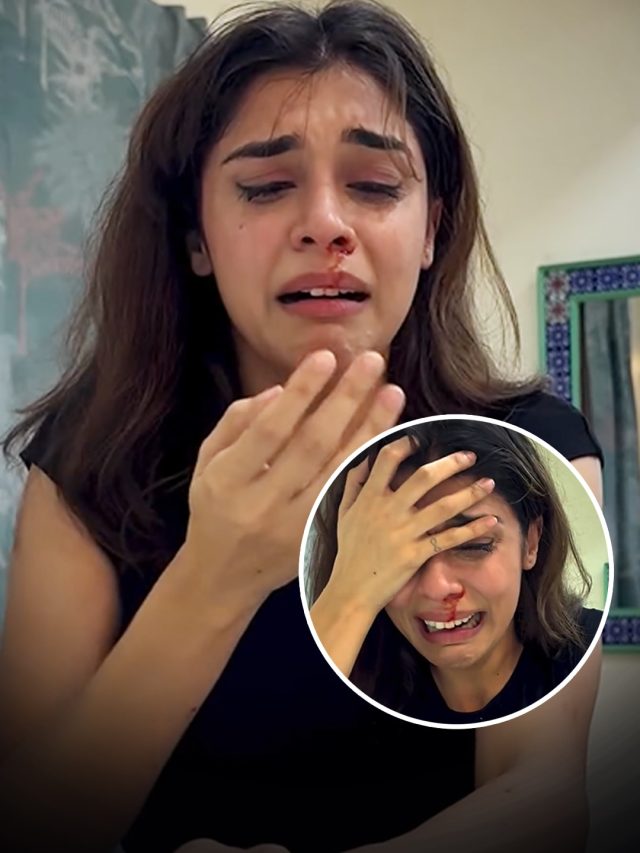 नाक से बहता खून-आंखों में आंसू, रोती बिलखती एक्ट्रेस का बुरा हाल, Video देख शॉक्ड फैंस
