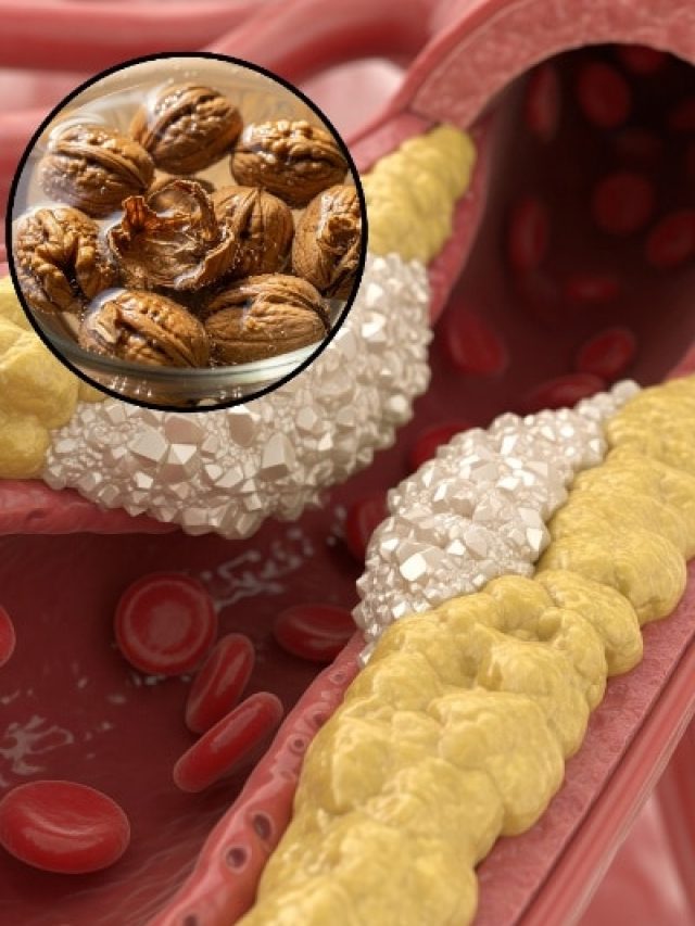 अखरोट से कम होता है 'खराब' कोलेस्ट्रॉल! डॉक्टर ने बताया खाने का सही तरीका