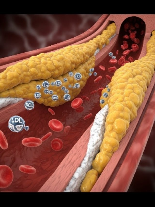 हाई कोलेस्ट्रॉल कम करने में दवा बेअसर? न्यूट्रिशनिस्ट ने बताए Cholesterol घटाने के 3 पक्के उपाय