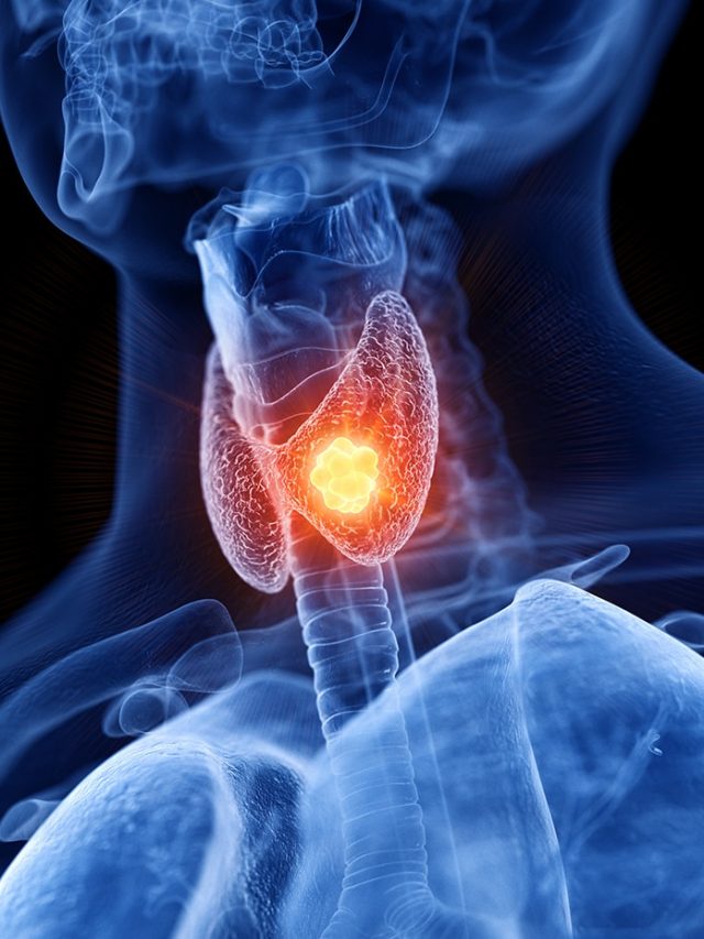 9 foods your thyroid notices: What to eat and avoid for hormone balance