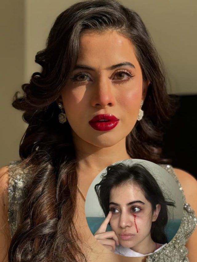 सूजी हुई आंख, चेहरे से टपकता खून, उर्फी जावेद का हुआ ऐसा हाल, क्या है असली वजह?