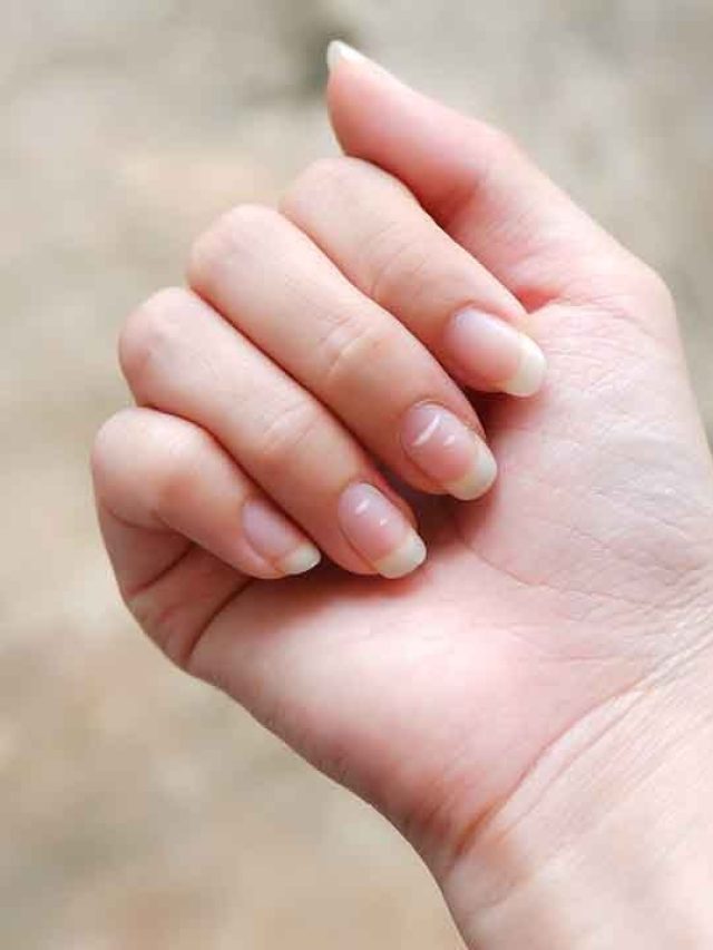 Not just cosmetic: the eerie medical warnings etched into your fingernails