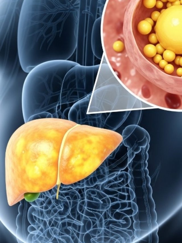 आपका लिवर हो रहा फैटी? शरीर में दिखते हैं ये 8 संकेत, न करें इग्नोर