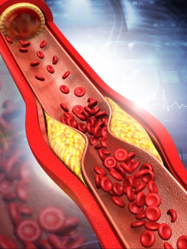 नसों में जमा गंदा कोलेस्ट्रॉल निकाल फेंकेगी ये एक चीज, रोज बस ऐसे करें सेवन