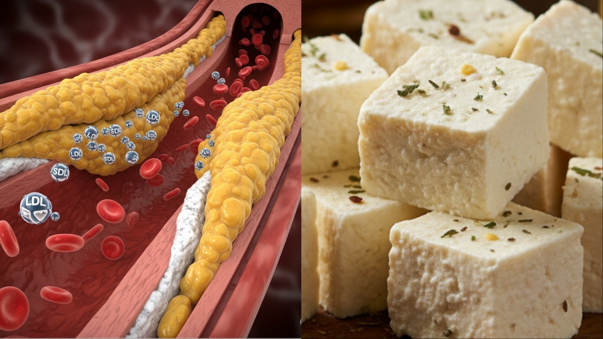 क्या कोलेस्ट्रॉल की बीमारी में पनीर खा सकते हैं? जान लें ये बात