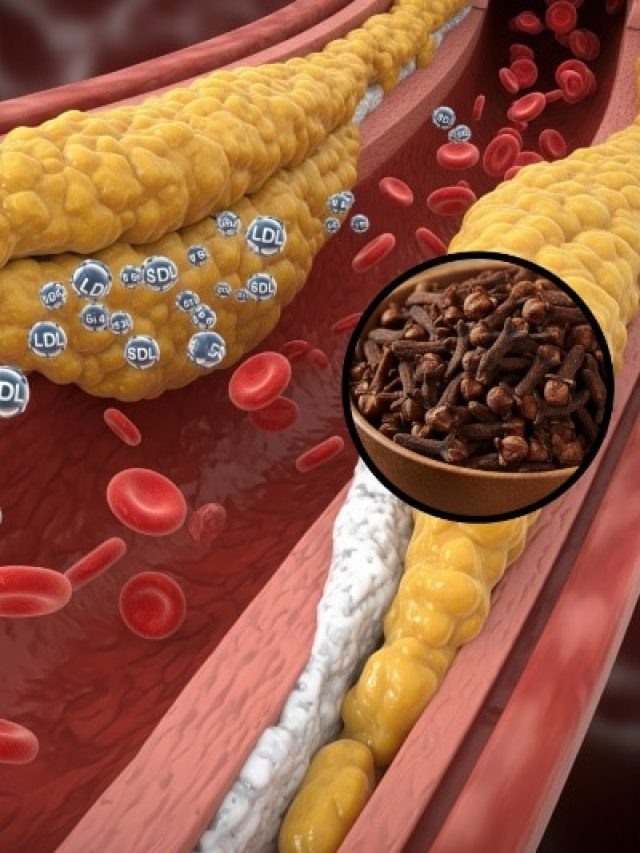 हाई कोलेस्ट्रॉल का रामबाण इलाज है यह मसाला! जान लें इसे खाने का सही तरीका