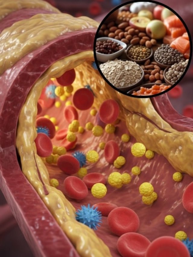 बैड कोलेस्ट्रॉल के दुश्मन हैं ये 6 फूड्स! आज ही करें इन्हें अपनी डाइट में शामिल