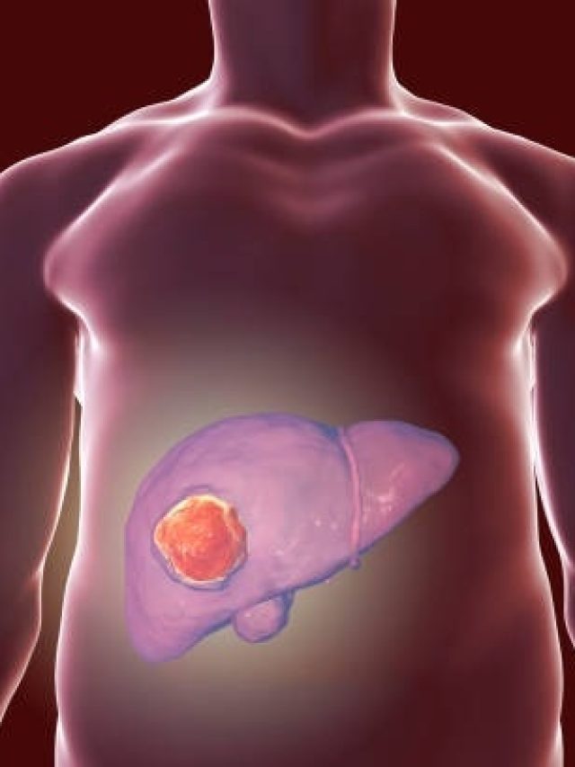 शरीर में ये 8 संकेत फैटी लिवर की निशानी... एक भी नजरअंदाज करना खतरनाक