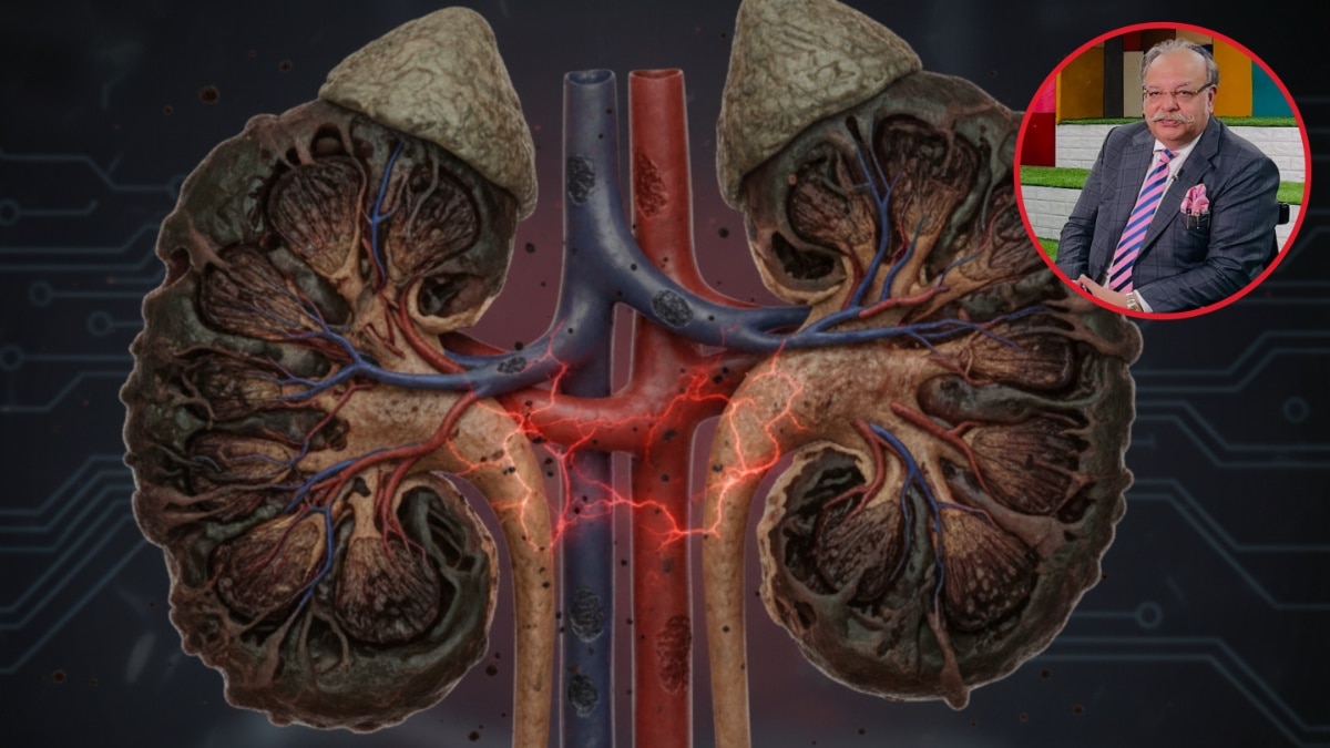 डॉ. संजीव बगई ने बताए किडनी फेलियर के 'साइलेंट' संकेत! देर होने से पहले पहचानें खतरा