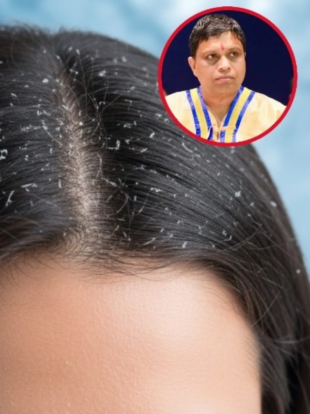 डैंड्रफ-खुजली की होगी छुट्टी! बालों पर आजमाएं आचार्य बालकृष्ण का ये देसी नुस्खा