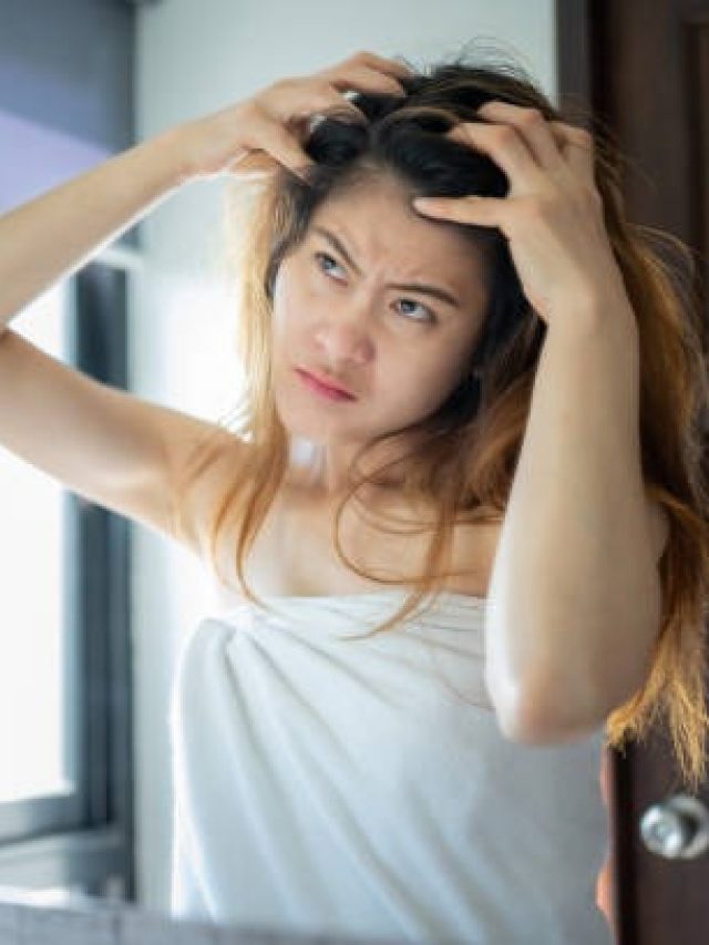 सर्दियों में बढ़ गई है रूसी की समस्या तो अपनाएं ये ट्रिक्स, डैंड्रफ का होगा जड़ से सफाया