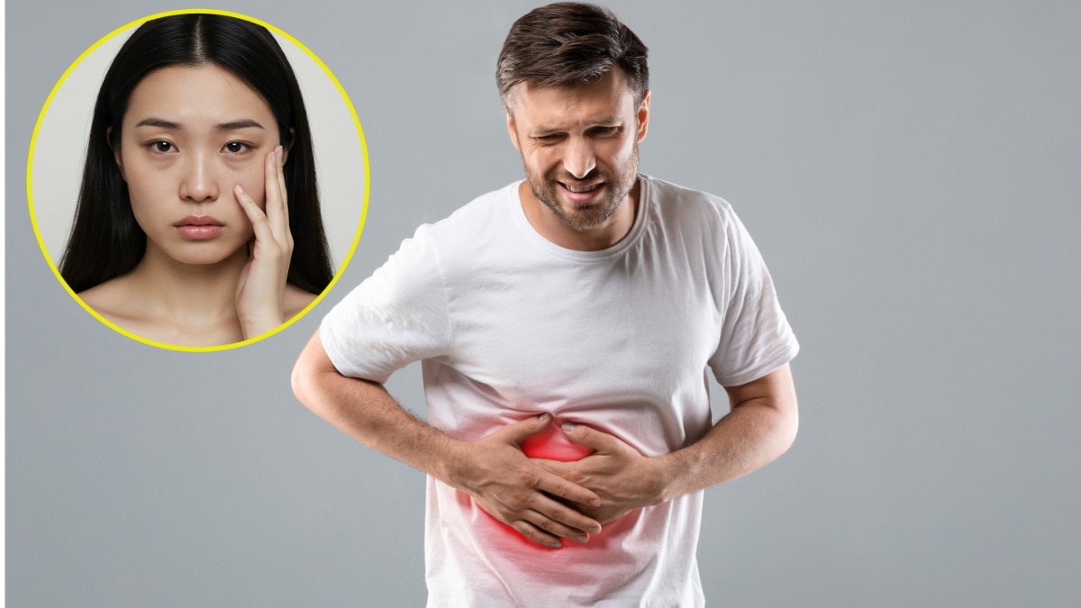 क्या आपकी आंखों का रंग बदल रहा है? लिवर फेलियर का हो सकता है संकेत