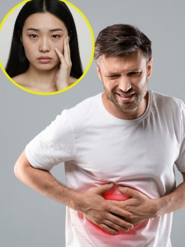 क्या आपकी आंखों का रंग बदल रहा है? लिवर फेलियर का हो सकता है संकेत