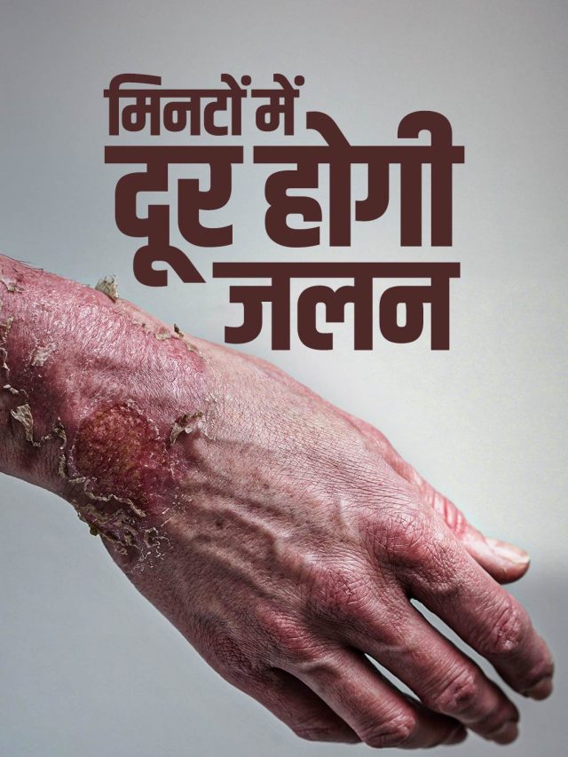 तलते वक्त जल गया है हाथ? घर में रखीं ये चीजें तुरंत देंगी राहत, नहीं पडे़ंगे फफोले